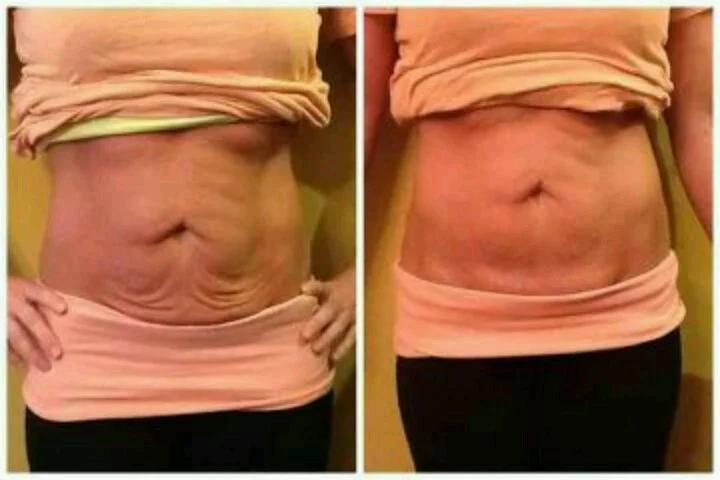 Before and after with XeiuC Collagen Oil